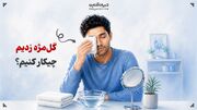 مراقبت‌های حیاتی هنگام ابتلا به گل‌مژه
