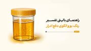 راهنمای بالینی تفسیر رنگ، بو و الگوی دفع ادرار