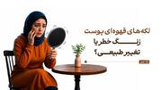 لکه‌های قهوه‌ای پوست؛ زنگ خطر یا تغییر طبیعی؟