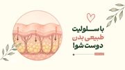 با سلولیت طبیعی بدن دوست شو!