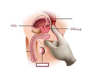 پرسش وپاسخ با دکتر ناطق درباره پروستاتیت