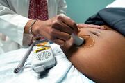 Analysis | Why hospitals in many states with legal abortion may refuse to perform them