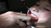 بیماری‌های خطرناکی که با دندان ارتباط ندارند، اما از دهان بروز می‌کنند